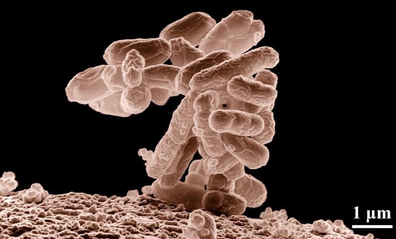 Archivo - Imagen de microscopio de la bacteria Escherichia coli - USDA - Archivo