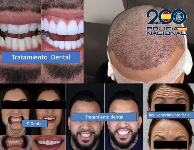 Algunos de los detenidos se financiaron operaciones de estética con el dinero defraudado. Imagen: Policía Nacional